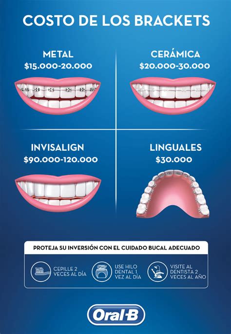 brackets de zafiro o metalicos|cuanto cuesta ponerse brackets.